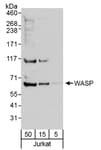 Detection of human WASP by western blot.