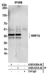 Detection of human RRP15 by western blot of immunoprecipitates.