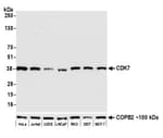 Detection of human CDK7 by western blot.