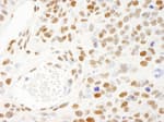 Detection of mouse KSRP by immunohistochemistry.