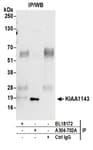 Detection of human KIAA1143 by western blot of immunoprecipitates.