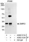 Detection of human ZNRF2 by western blot of immunoprecipitates.