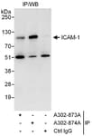 Detection of human ICAM-1 by western blot of immunoprecipitates.
