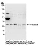 Detection of human and mouse Syntaxin 6 by western blot.