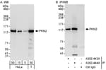 Detection of human PKN2 by western blot and immunoprecipitation.