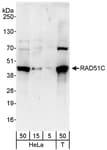 Detection of human RAD51C by western blot.