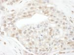 Detection of human Cyclin T1 by immunohistochemistry.