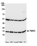 Detection of human and mouse TMED2 by western blot.