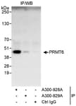 Detection of human PRMT6 by western blot of immunoprecipitates.