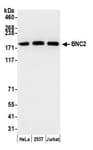 Detection of human BNC2 by western blot.
