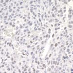 Detection of mouse ZEB1 by immunohistochemistry.