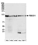 Detection of human FBXO11 by western blot.