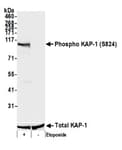 Detection of mouse Phospho KAP-1 (S824) by western blot.