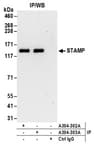 Detection of human STAMP by western blot of immunoprecipitates.