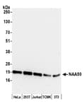Detection of human and mouse NAA50 by western blot.