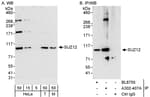 Detection of human and mouse SUZ12 by western blot (h &amp; m) and immunoprecipitation (h).