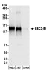 Detection of human SEC24B by western blot.