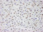 Detection of mouse CRM1 (Exportin 1) by immunohistochemistry.
