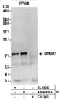 Detection of human MTMR1 by western blot of immunoprecipitates.