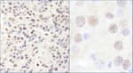 Detection of human and mouse CHD3 by immunohistochemistry.