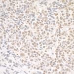 Detection of mouse SMC1 by immunohistochemistry.
