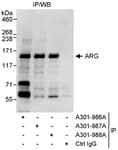 Detection of human ARG by western blot of immunoprecipitates.