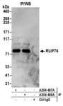 Detection of human RLIP76 by western blot of immunoprecipitates.