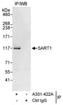 Detection of human SART1 by western blot of immunoprecipitates.