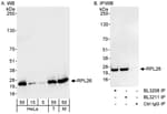 Detection of human and mouse RPL26 by western blot (h and m) and immunoprecipitation (m).