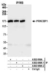 Detection of human PRKCBP1 by western blot of immunoprecipitates.