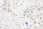 Detection of human DC8 by immunohistochemistry.