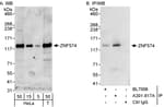 Detection of human ZNF574 by western blot and immunoprecipitation.