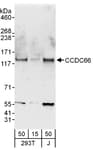Detection of human CCDC66 by western blot.