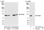 Detection of human and mouse KPNB1 by western blot (h&amp;m) and immunoprecipitation (h).