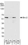 Detection of human Brn-2 by western blot.
