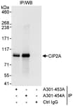 Detection of human CIP2A by western blot of immunoprecipitates.