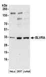 Detection of human BLVRA by western blot.