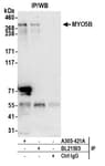 Detection of human MYO5B by western blot of immunoprecipitates.