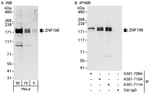 Detection of human ZNF198 by western blot and immunoprecipitation.
