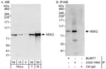 Detection of human and mouse MSK2 by western blot (h&amp;m) and immunoprecipitation (h).