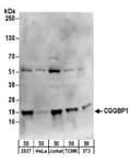 Detection of human and mouse CGGBP1 by western blot.
