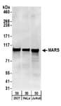Detection of human MARS by western blot.