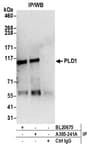Detection of human PLD1 by western blot of immunoprecipitates.