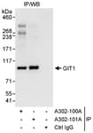 Detection of human GIT1 by western blot of immunoprecipitates.