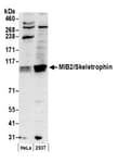 Detection of human MIB2/Skeletrophin by western blot.