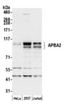 Detection of human APBA2 by western blot.