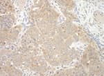 Detection of mouse NEDD4L by immunohistochemistry.