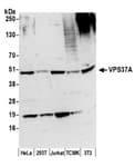 Detection of human and mouse VPS37A by western blot.