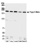 Detection of human and mouse Topo II Beta by western blot.