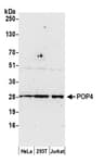 Detection of human POP4 by western blot.